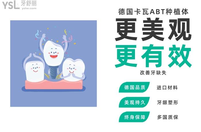 德國(guó)卡瓦ABT種植體多少錢一顆.jpg