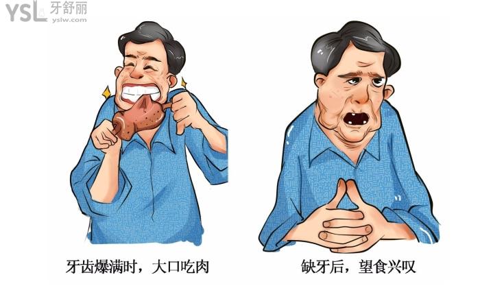 帶你們深扒美國百康種植牙 看看它到底怎么樣.jpg