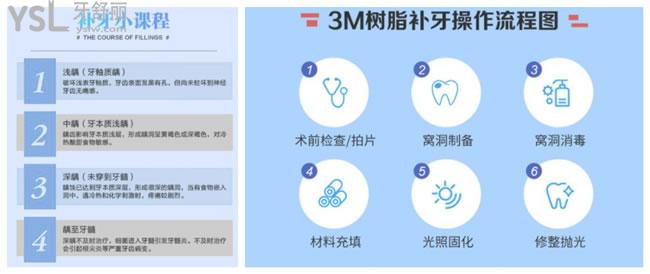 補(bǔ)牙過程