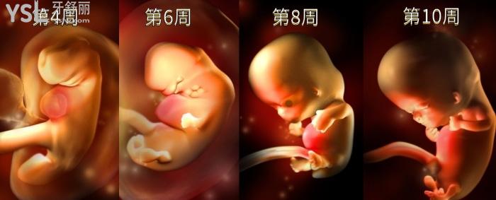 腭裂唇是什么原因，如何預(yù)防？.jpg