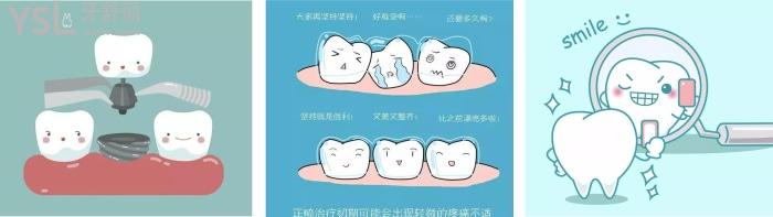 種植牙 隱形矯正圖片.jpg