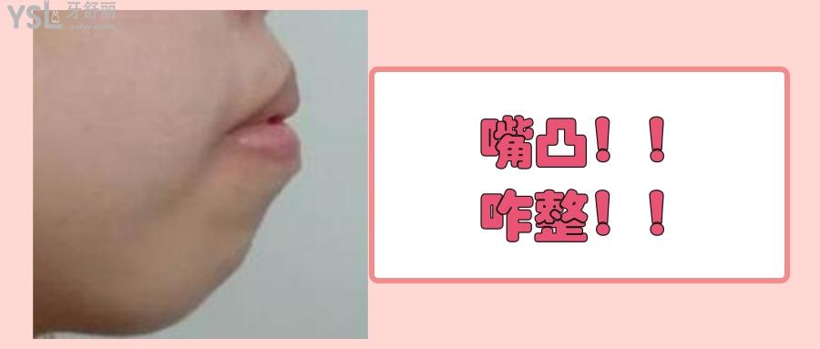 為什么正畸越整嘴越凸