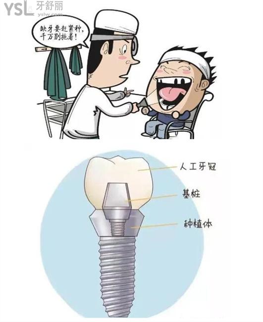卡通種植牙圖片