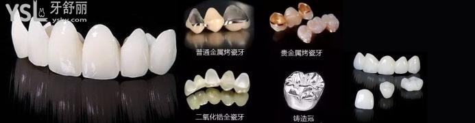 1200一顆的全瓷牙能做嗎.jpg