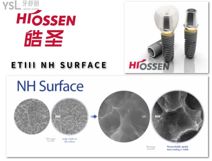 美國HIOSSEN皓圣種植體