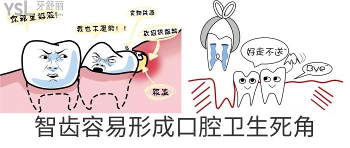 拔完智齒多久