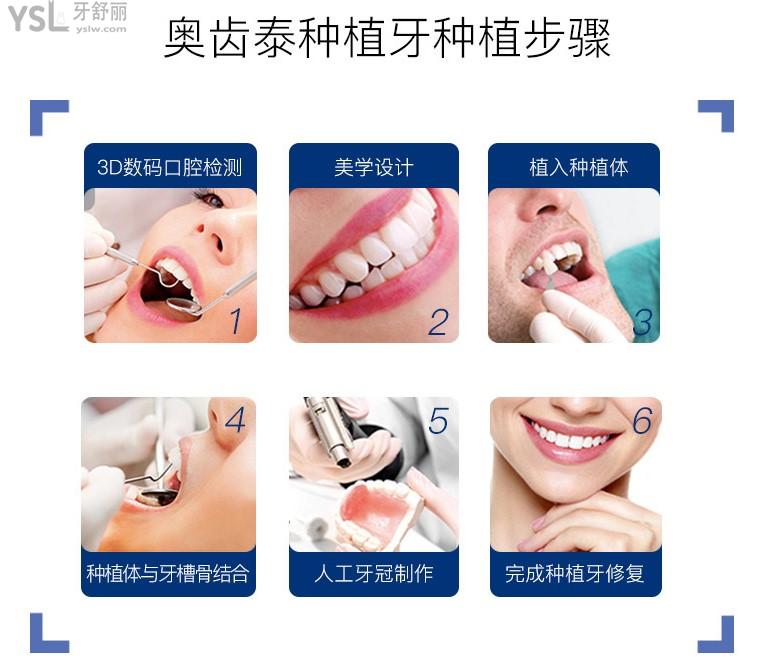 韓國奧齒泰缺點(diǎn).jpg