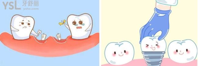 種植牙卡通圖畫.jpg