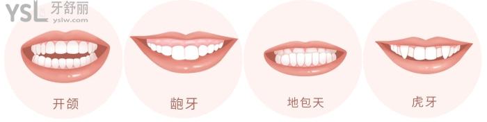 成人盡量不要矯正牙齒？究竟是有風險還是怕你<span style=