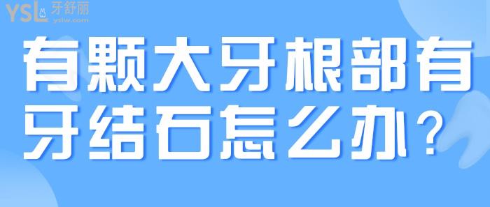 有顆大牙根部有牙結(jié)石怎么辦？.jpg
