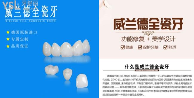 德國威蘭德全瓷牙