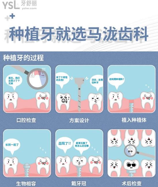 鄭州馬瀧齒科種植過(guò)程圖