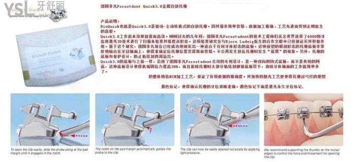 金屬自鎖和陶瓷自鎖哪個好，有哪些牌子求推薦！.jpg