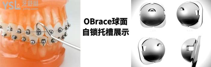 金屬自鎖和陶瓷自鎖哪個好，有哪些牌子求推薦！.jpg