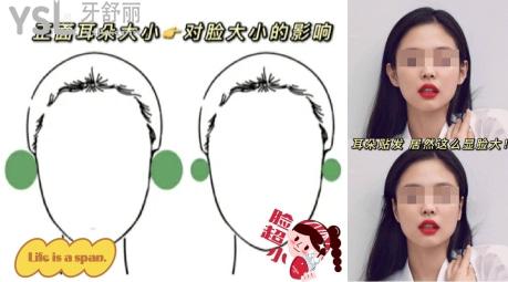 兩只耳朵長(zhǎng)得太貼后可以改善嗎.jpg