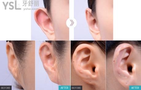 兩只耳朵長(zhǎng)得太貼后可以改善嗎.jpg