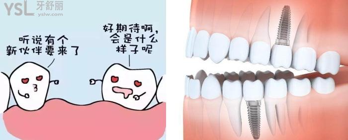 福州維樂口腔門診部做種植牙嗎？有沒有推薦的醫(yī)生？大概多少錢？.jpg