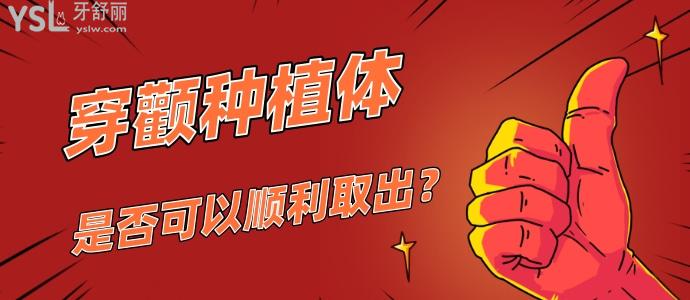 穿顴種植體是什么，是否可以順利取出
