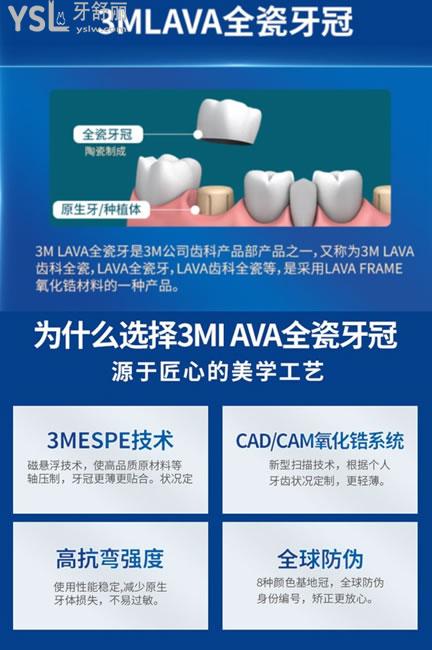 美國3M lawe全瓷牙特點