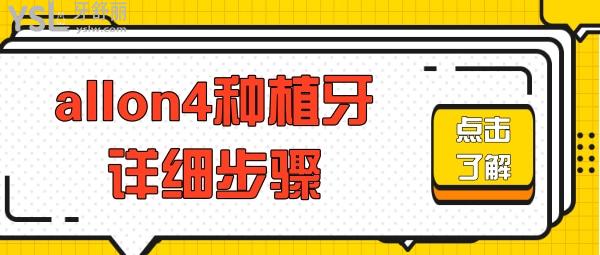 allon4種植牙詳細步驟