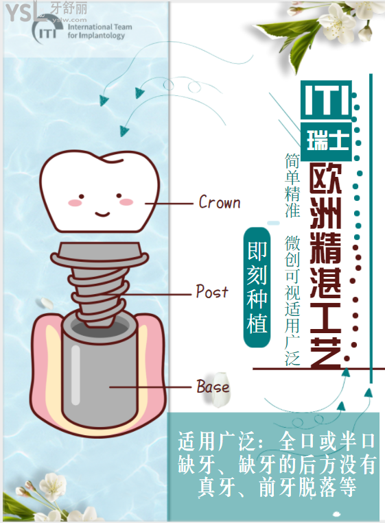 種植牙意大利bb和瑞士iti哪個(gè)好,有啥區(qū)別？png