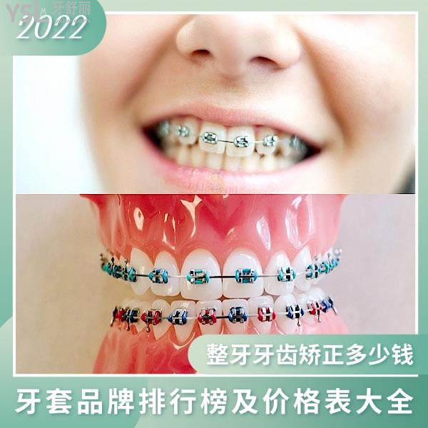 常見(jiàn)金屬自鎖托槽名單及價(jià)格表