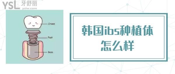 韓國ibs種植體怎么樣