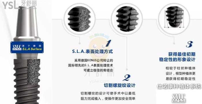 韓國仕諾康和奧齒泰哪個好？看完對比再做種植牙也不遲！.jpg