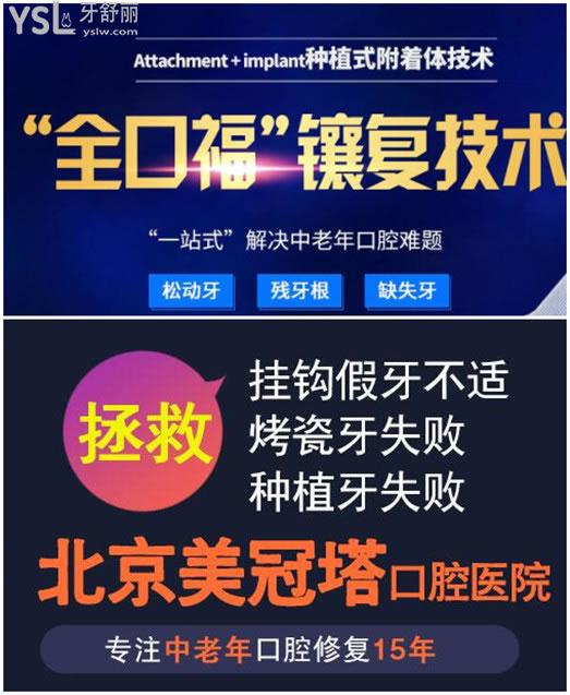 北京美冠塔口腔診所種牙價格表