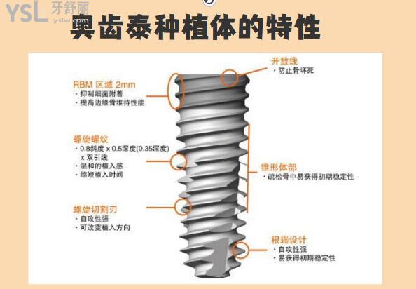韓國奧齒泰種植牙的使用壽命跟這幾點息息相關 大家一定要了解.jpg
