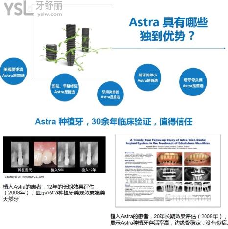 astra和諾貝爾/Nobel區(qū)別