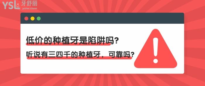 三四千的種植牙可靠嗎