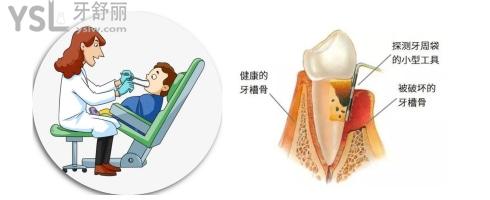 牙槽骨圖片