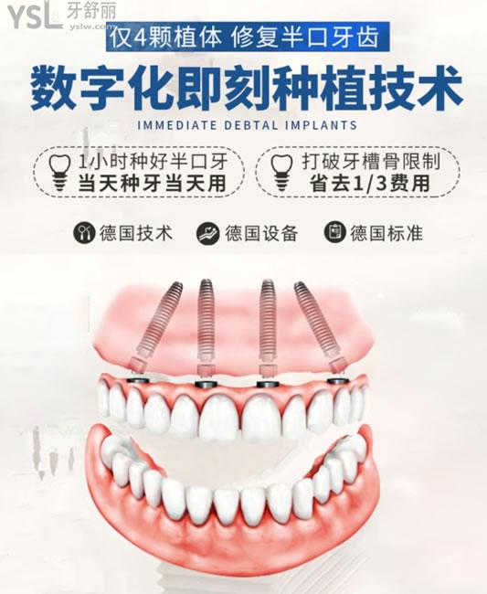 深圳諾德齒科種植牙技術(shù)優(yōu)勢(shì)