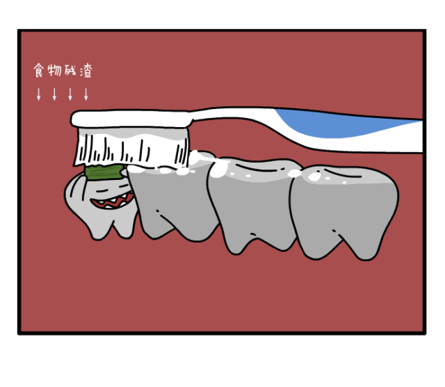 佩戴臨時牙冠的作用和制作方法
