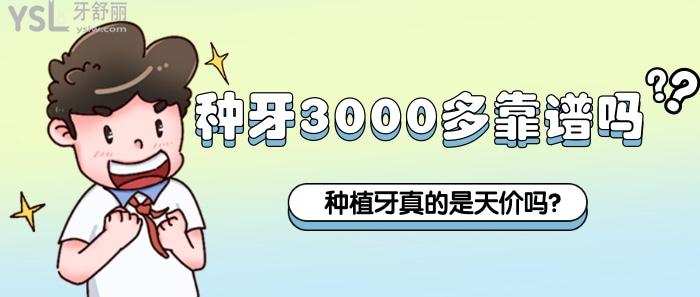 種牙3000多靠譜嗎