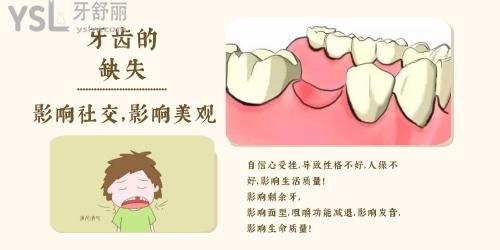 牙齒缺失的后果