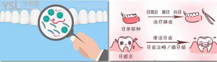 長期口氣臭是什么原因？怎么辦治療好？
