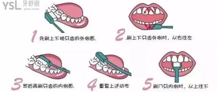 長期口氣臭是什么原因？怎么辦治療好？