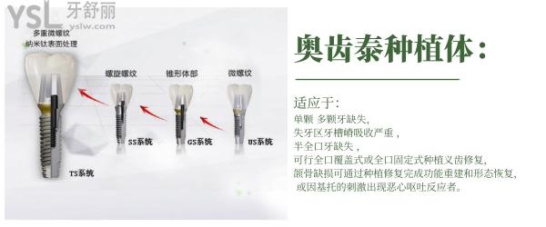 韓國奧齒泰種植體