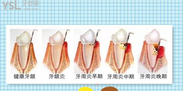 請問大牙牙床疼是什么原因?qū)е碌?.jpg