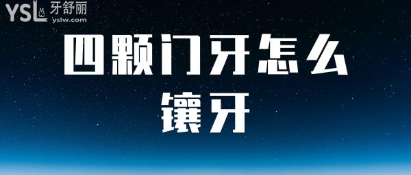 四顆門牙怎么鑲牙
