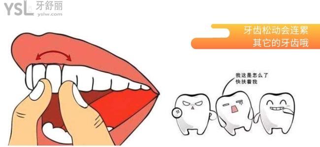 牙齒松動