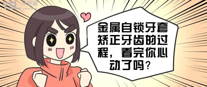 金屬自鎖牙套矯正牙齒的過程