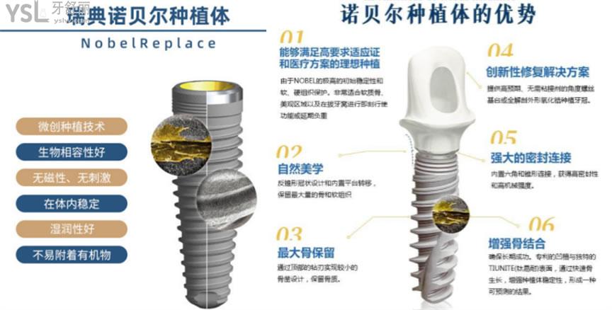 瑞典諾貝爾種植體有幾個型號