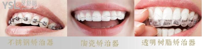 舌側(cè)矯正影響說(shuō)話嗎？如何選擇矯治器呢？