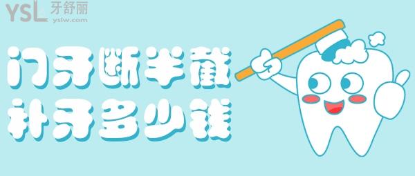 門牙斷半截補牙多少錢