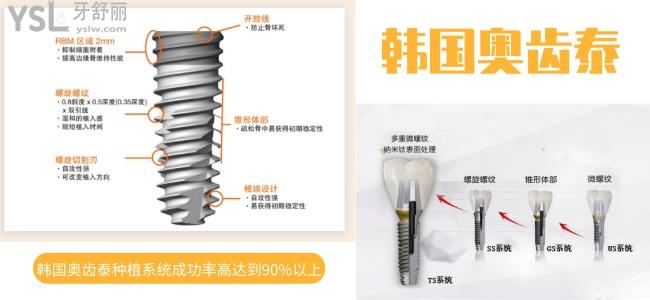 韓國(guó)奧齒泰種植體
