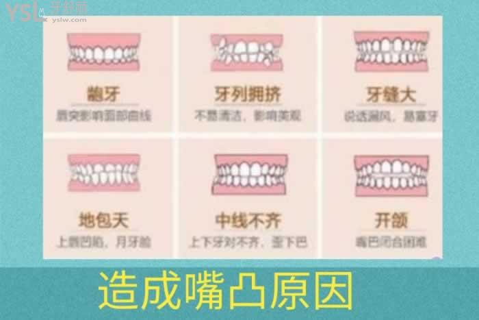 手術(shù)矯正嘴凸一般需要多少錢