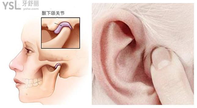 牙掉不管會怎么樣
